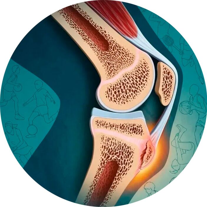 Struktura stawu i otaczających tkanek