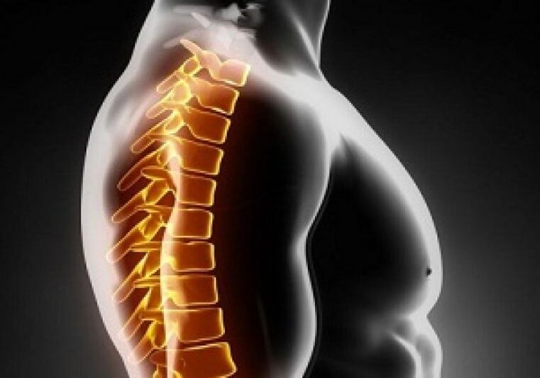 Osteochondroza klatki piersiowej towarzyszy bólowi i dyskomfortowi w środkowej części pleców