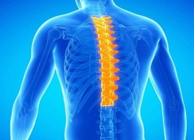 Osteochondroza odcinka piersiowego kręgosłupa