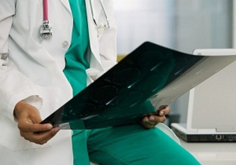 Rentgen pomoże lekarzowi zdiagnozować „osteochondrozę kręgosłupa piersiowego”