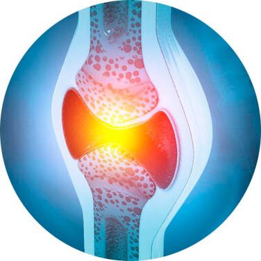 proces odbudowy stawów żelem Icexin
